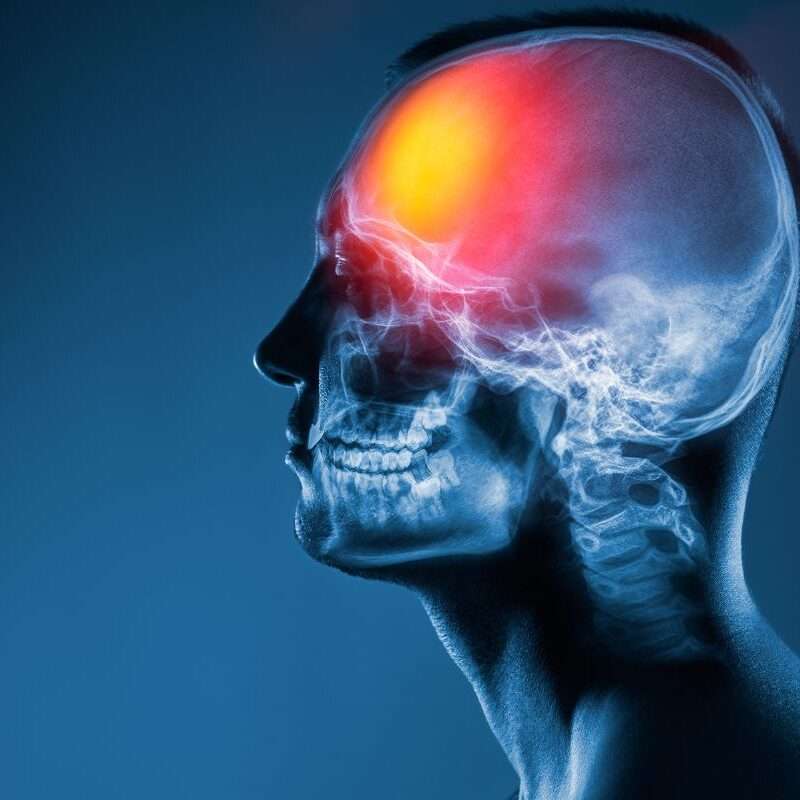 Neurosurgery