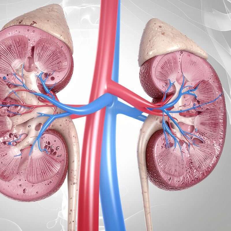 Kidney Transplant